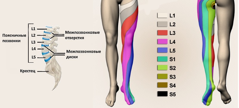 Обратите внимание где локализуется боль при грыже поясницы