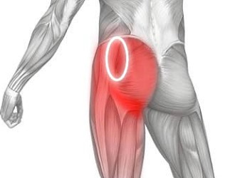 Делать упражнения запрещено при острой фазе ишиаса
