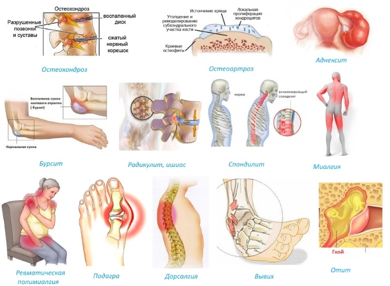 Показания для применения Флексена