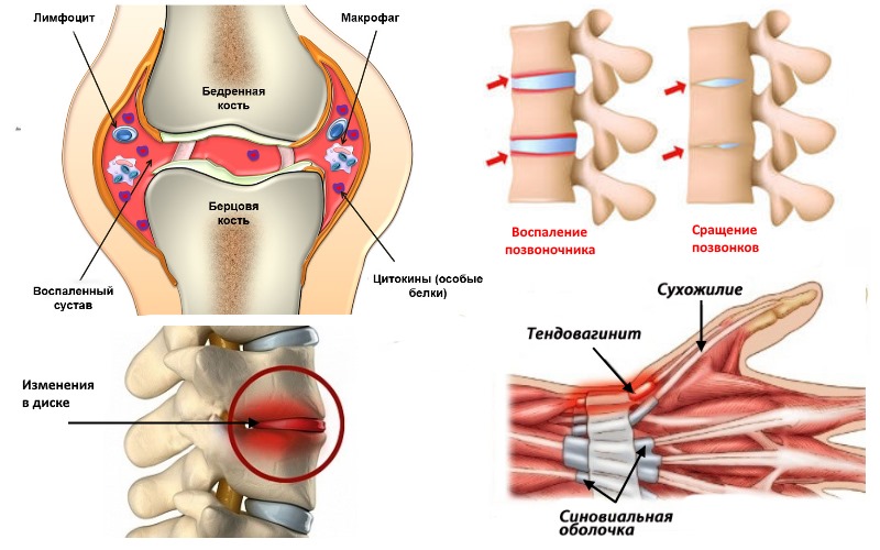 Ниже представлен более широкий список показаний к применению Тексамена