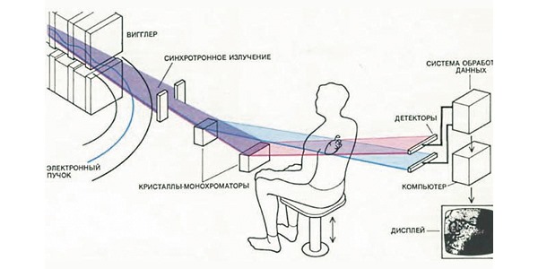 Обычно рентген грудного отдела делают в двух проекциях