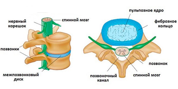 Грыжа образуется из-за чрезмерной нагрузки на позвоночный диск и разрыва фиброзного кольца