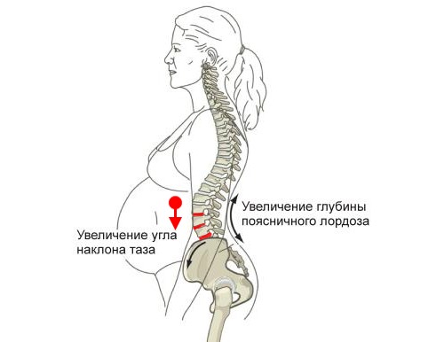 Обратите внимание, что во время беременности из-за смещенного центра тяжести женщины испытывают большие нагрузки в области поясницы