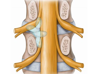 Симптомы кисты в позвоночнике возникают в следствии защемления нервных корешков