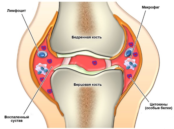 Orihiro устраняет причины и симптомы заболеваний суставов