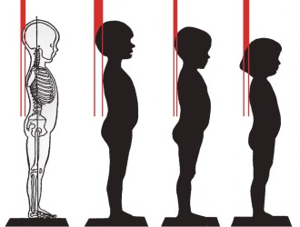 Для профилактики кифоза необходимо следить за осанкой