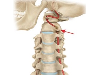 Обратите внимание на самые распространенные причины аномалии Киммерли