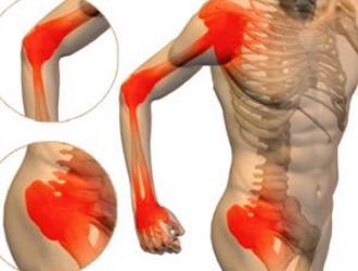 Среди побочных реакций препарата могут отмечаться суставные боли
