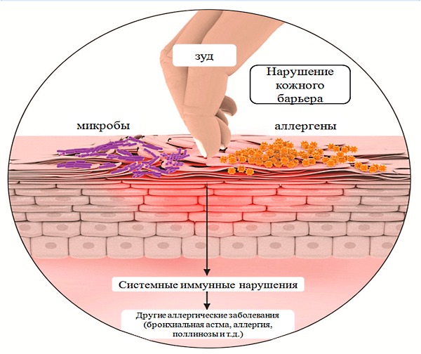 Меновазин можно использовать при кожном дерматозе