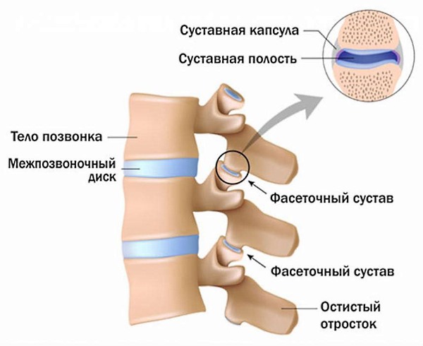 При артрозе в позвоночнике повреждается хрящевая ткань суставов и межпозвонковых дисков