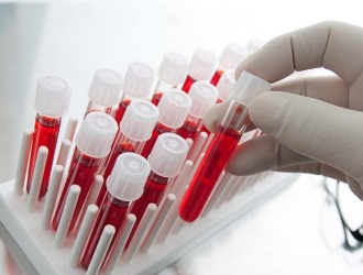 Перед применением бисфосфоната необходимо определить уровень креатинина, магния, фосфора и кальция в крови