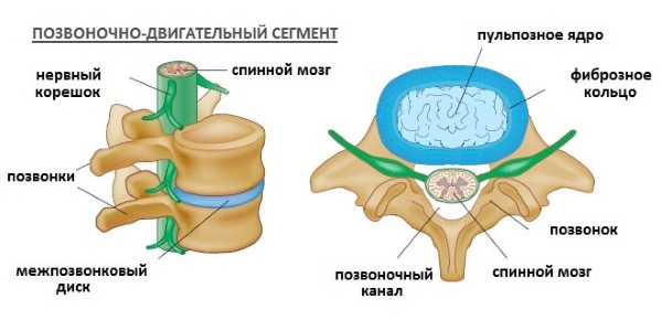Остеохондроз - это разрушения хрящевой ткани в межпозвонковых дисках