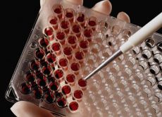 анализ крови