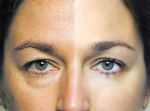 бледность кожи на лице