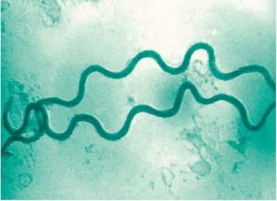 бледная трепонема