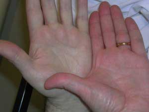 бледные руки