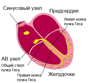 блокада сердца