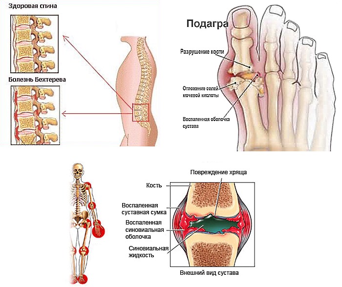 Обратите внимание на болезни, при которых назначают Метиндол Ретард