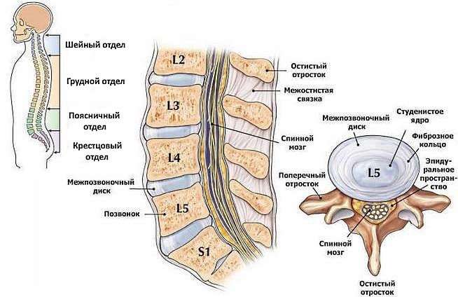 Грыжа чаще всего возникает между позвонками L4, L5, S1
