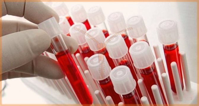 боязнь крови