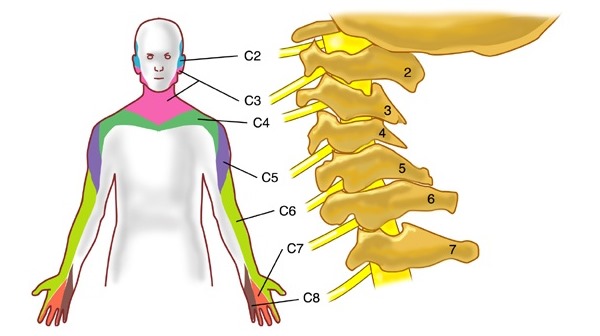 Обратите внимание как распространяется боль при защемлении корешков в шейном отделе