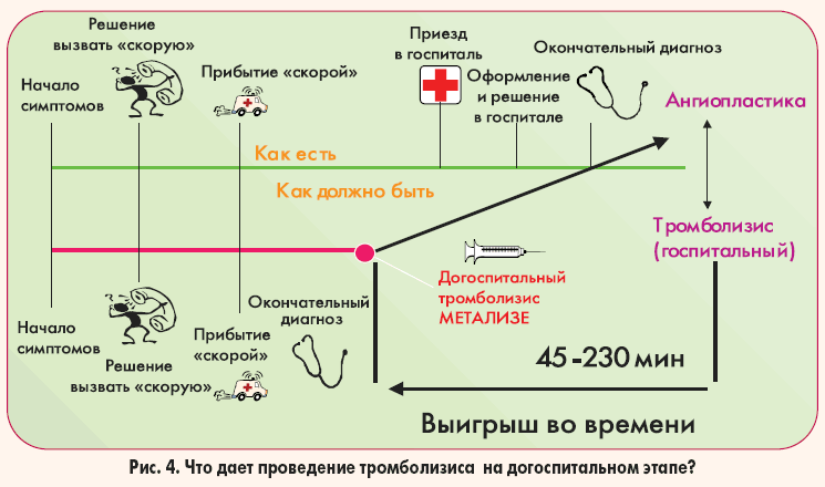что даёт тромболизис