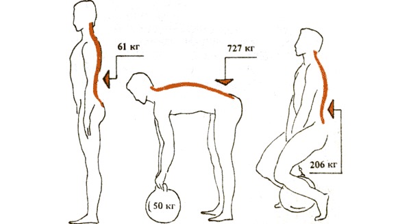 Так как осетофиты разрастаются из-за перегрузки спины, обратите внимание какие нагрузки испытывает позвоночник при разном положении тела