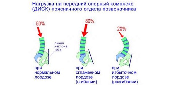 Поясничная зона больше всего подвержена появлению болей в ней из-за сильных нагрузок