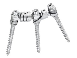 При сколиозе 3 степени как правило могут применяться хирургические вмешательства