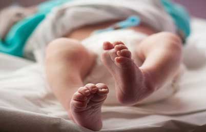 деформация ног у ребенка