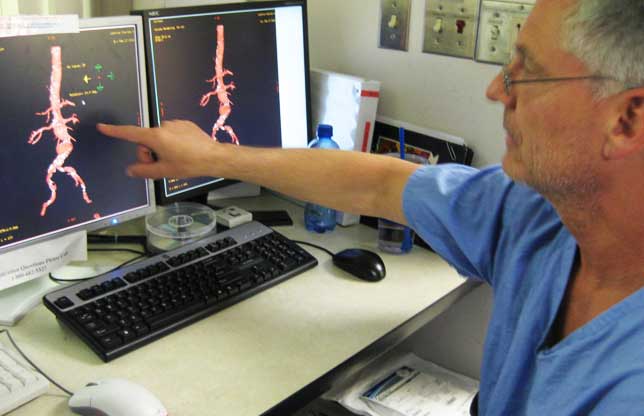 диагностика аорты сердца