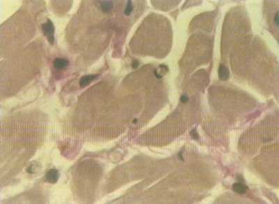 дифузорный вид