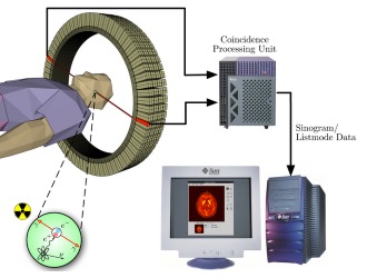 Для проведения томографии не требуется особой подготовки