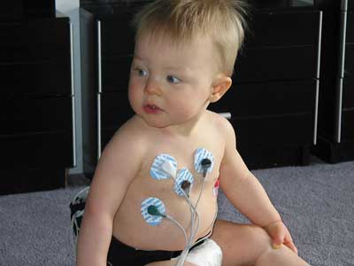 ЭКГ у детей