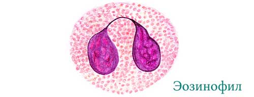 эозинофилы