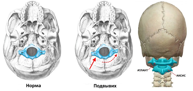 Атлант отвечает за крепление черепа к позвоночнику