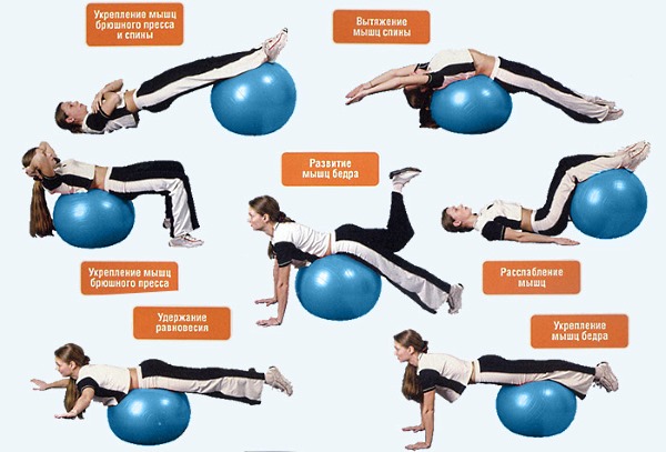 При занятиях лечебной физкультурой можно воспользоваться фитболом