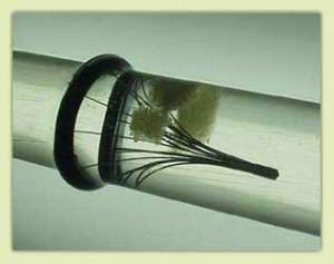 установленный в вену фильтр