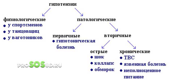 формы гипотензии