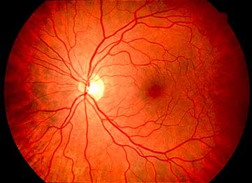 глазное дно