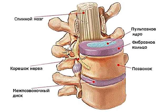 Больше всего при остеохондрозе страдает межпозвоночный диск, в связи с чем после разрыва фиброзного кольца развивается грыжа