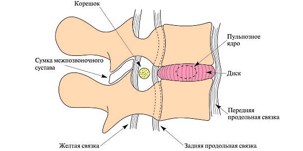 Для востановления тканей межпозвоночного диска придется принимать хондропротекторы не менее 3 месяцев