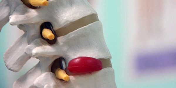 Ниже Вы можете ознакомиться со стадиями остеохондроза и их последствиями