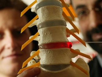 Обратите внимание, что делать, чтобы избежать выпячивания межпозвонкового диска