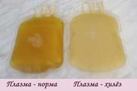 хилез крови