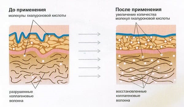Ксеомин обладает хорошим действием, однако оно не продолжительное