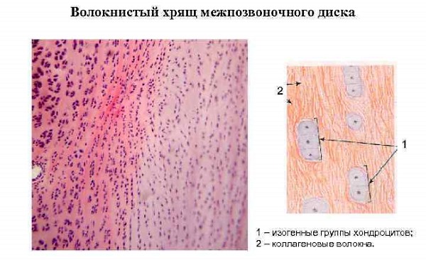 Хондроитин способствует насыщению хрящевой ткани влагой