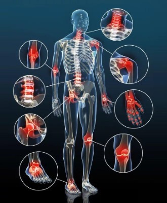 Отзывы о средстве для суставов в основном положительные