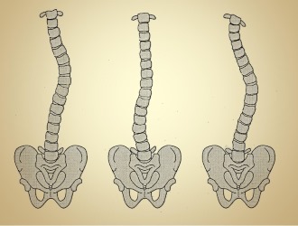 Обратите внимание в каких случаях можно лечить сколиоз в домашних условиях