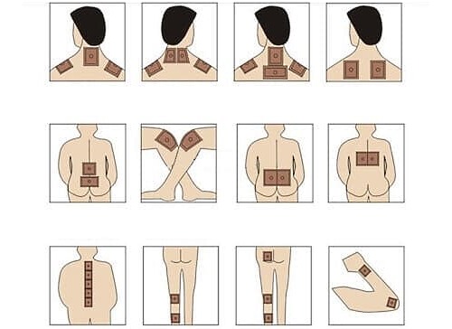 Куда и как клеить пластырь при различных заболеваниях описано ниже